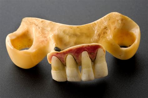 Are teeth made of bone?